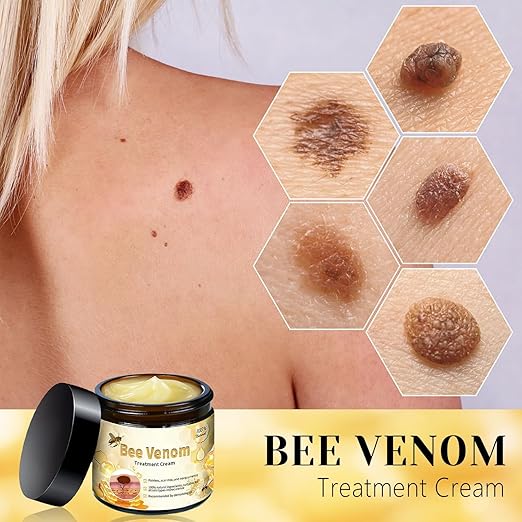 Bee Venom Cream for All Body Parts - arabiccart