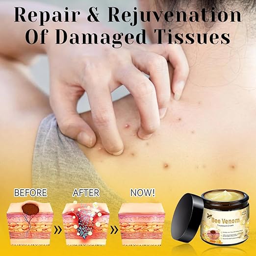 Bee Venom Cream for All Body Parts - arabiccart