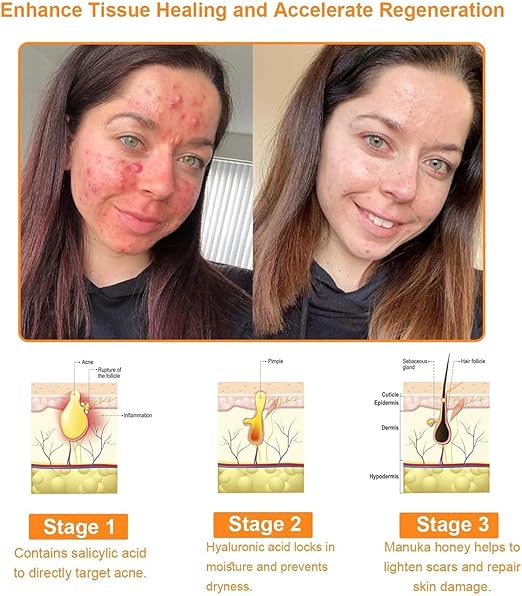 Bee Venom Cream for All Body Parts - arabiccart