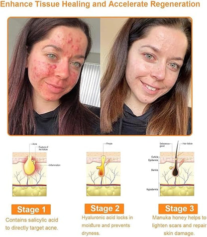 Bee Venom Cream for All Body Parts - arabiccart
