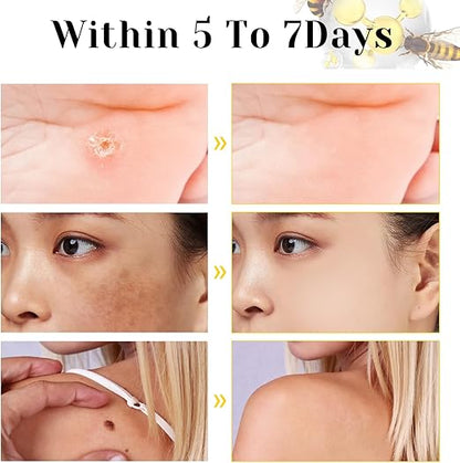 Bee Venom Cream for All Body Parts - arabiccart