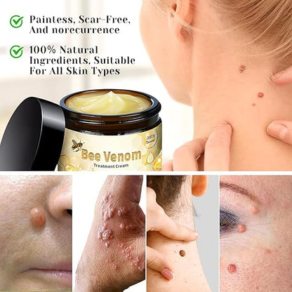 Bee Venom Cream for All Body Parts - arabiccart