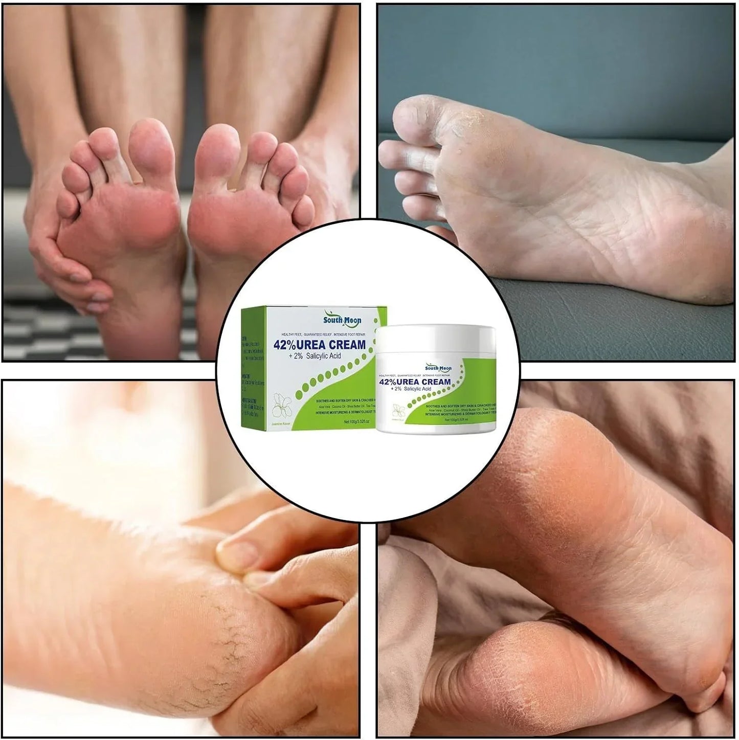 South Moon - 42% Urea Cream + 2% Salicylic Acid (Original) - arabiccart