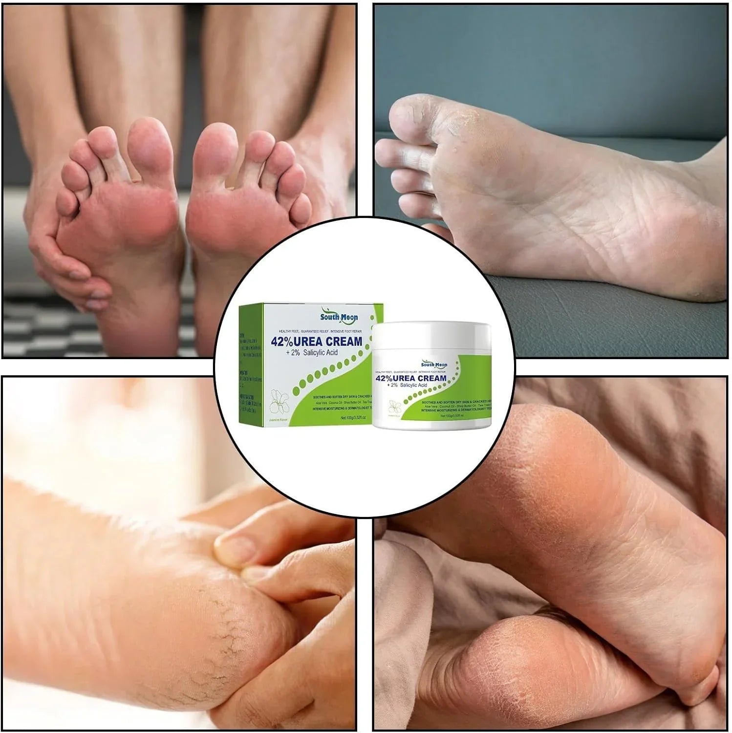 South Moon - 42% Urea Cream + 2% Salicylic Acid (Original) - arabiccart