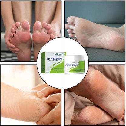 South Moon - 42% Urea Cream + 2% Salicylic Acid (Original) - arabiccart