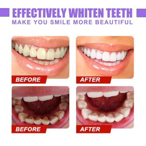 Purple Whitening Toothpaste™ ! ™معجون أسنان مبيض أرجواني - arabiccart